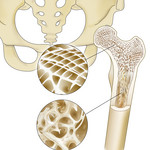 Zeichnung eines Skeletts mit einer Detailansicht eines Knochens.